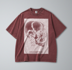 Oversized Snow Washed Cotton Tee - Human Skull Print